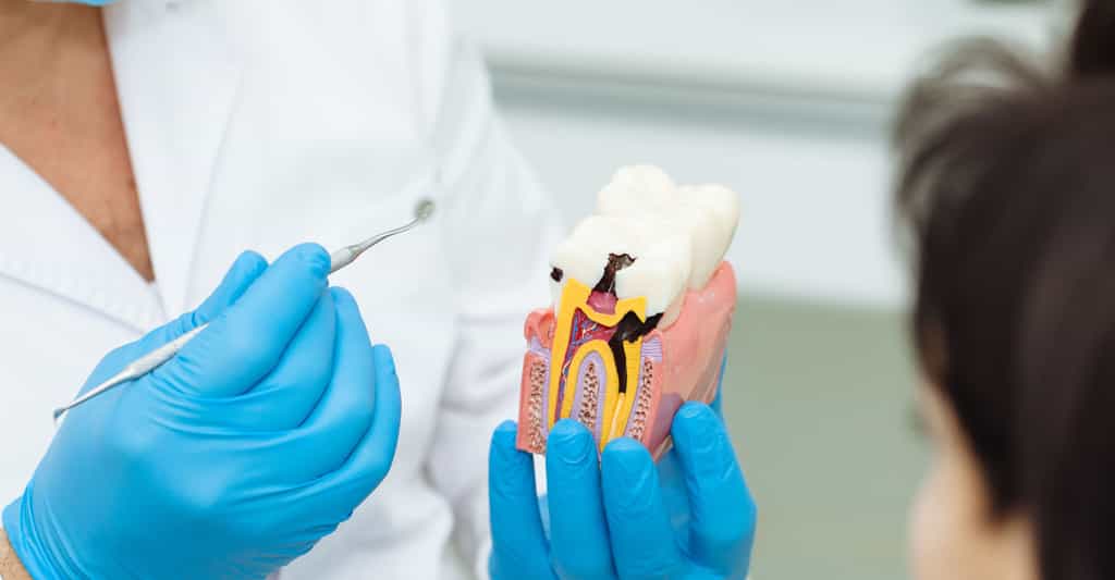 Parodontite : le déchaussement des dents