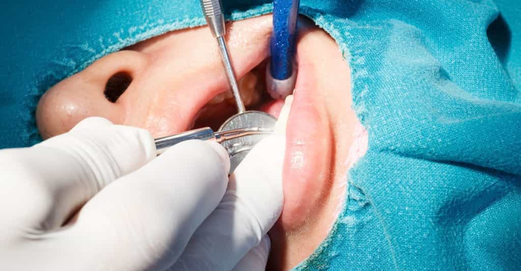 Caries et pulpite, des pathologies dentaires