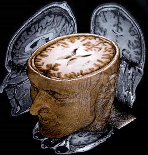 L'imagerie cérébrale pour comprendre les mécanismes du cerveau
