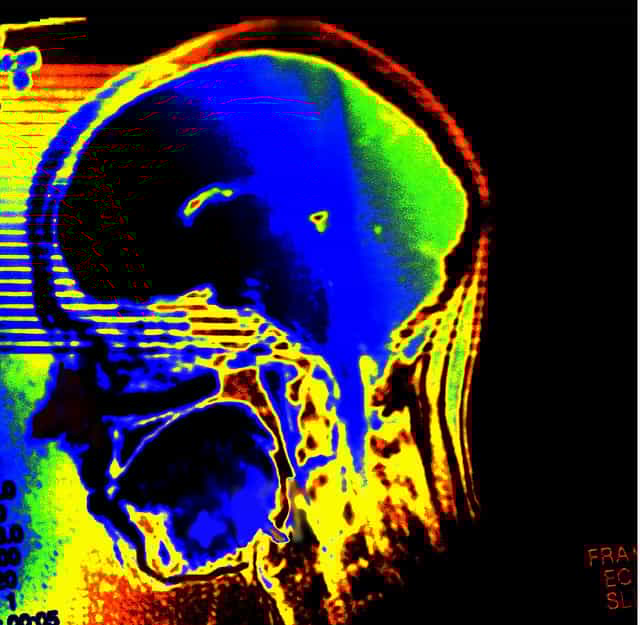 Maladies mentales : comprendre la souffrance psychique