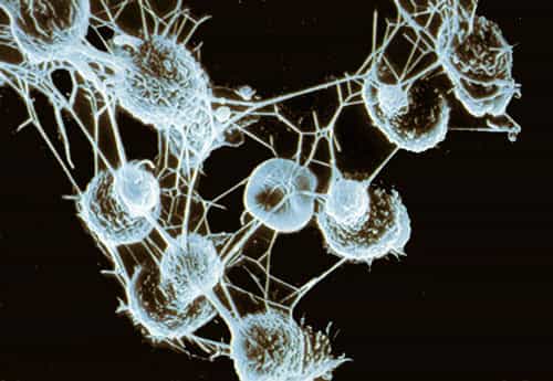Bactéries pathogènes pour l'homme