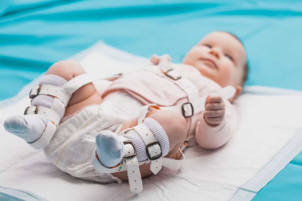 Bébé portant un harnais pour corriger une dysplasie de la hanche ©Dmytro Titov, Adobe Stock