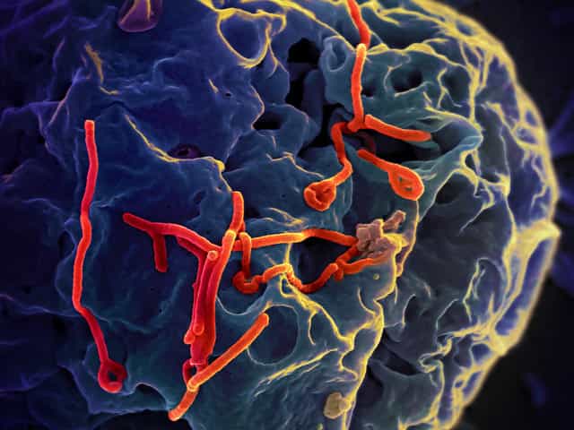 Des chercheurs ont peut-être trouvé la solution pour empêcher l’entrée et la progression du virus dans la cellule grâce à la tétrandrine, une molécule extraite de la liane Stephania tetrandra. © NIAID, Flickr, CC by 2.0