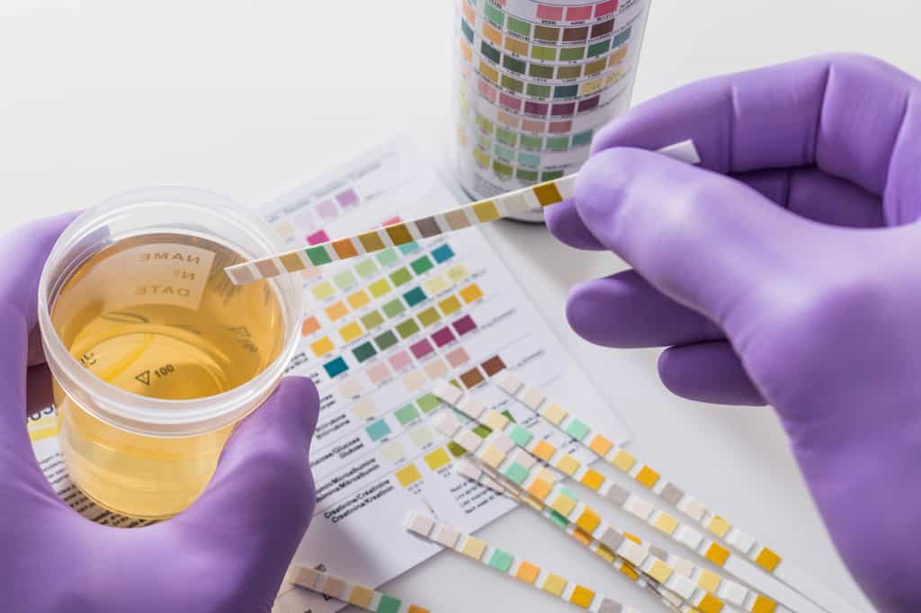 Un ECBU est un examen d'urines. © Lothar Drechsel, Adobe Stock