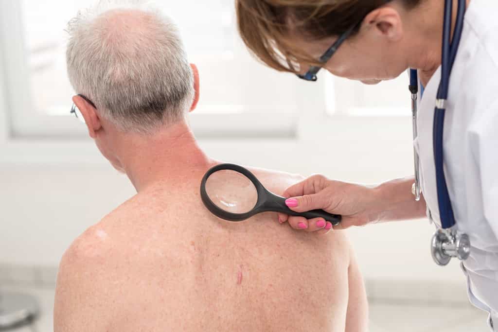 Les effets secondaires des traitements sur la peau affectent la qualité de vie de 93 % des malades. © Thodonal88, Shutterstock