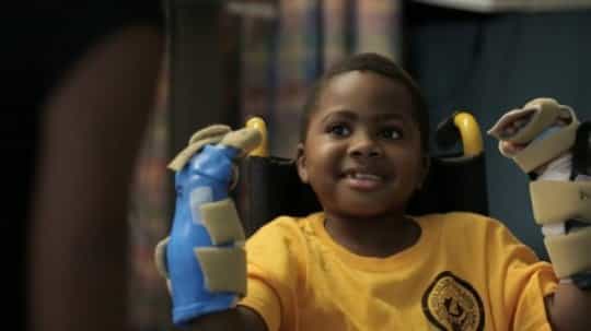 Zion Harvey est le premier enfant greffé des deux mains. © The Children's Hospital of Philadelphia
