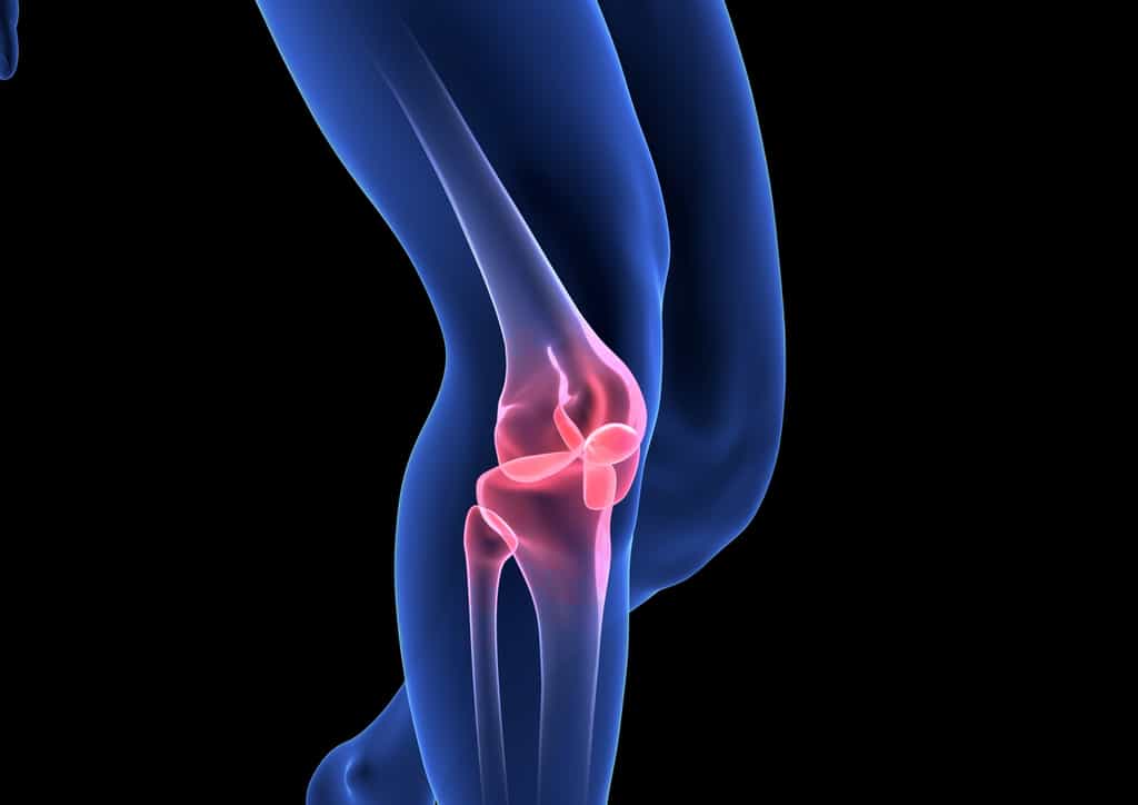L'arthrite septique se localise très fréquemment (40 %) sur l'articulation du genou. © m3ron, Fotolia