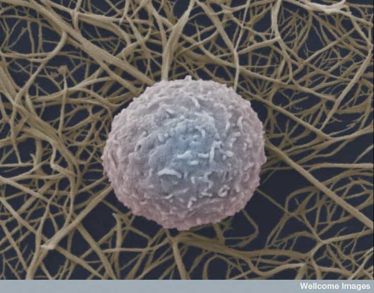 Les globules blancs, ou cellules immunitaires, interviennent dans la lutte contre les infections. Les deux principaux types sont les lymphocytes et les macrophages. Ces cellules peuvent également devenir cancéreuses et induire le développement d’un lymphome. © Anne Weston, Wellcome Images, Flickr, cc by nc nd 2.0