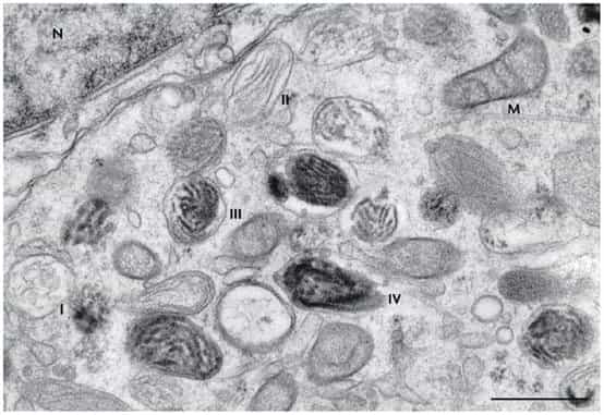 Un mélanocyte humain dans lequel des mélanosomes sont observés à différents stades de leur maturation (numérotés&nbsp;de I à IV). On remarque le noyau de la cellule (N) et une mitochondrie (M). La barre d'échelle représente 0,5 micron.&nbsp;©&nbsp;Graça Raposo &amp; Michael S. Marks/Nature Rewiews/Molecular Cell Biology