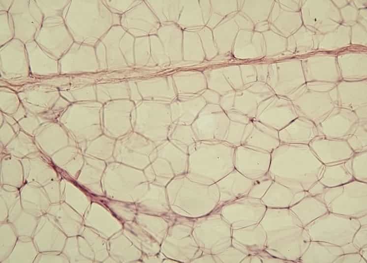 Le tissu adipeux est constitué d'adipocytes. © Reytan, Wikimedia, GFDL 1.2