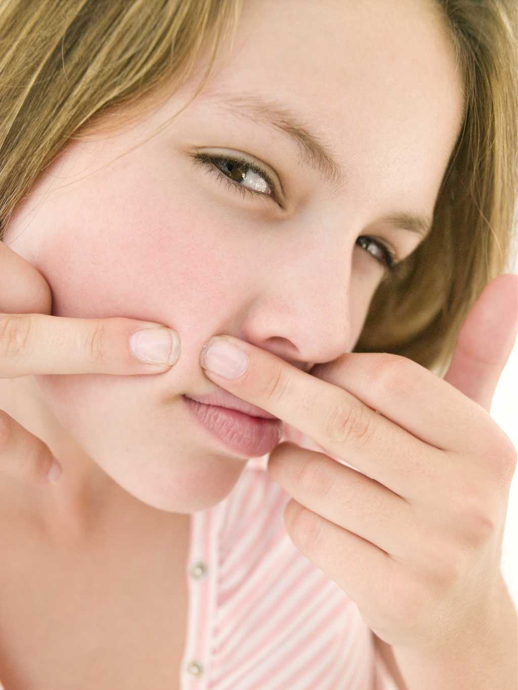 Les antiacnéiques permettent de réduire les manifestations de l’acné. © Phovoir