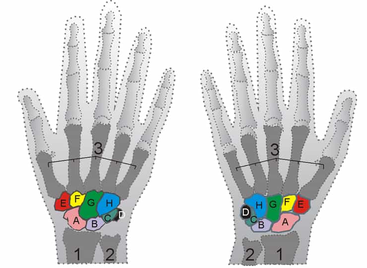 Squelette des mains droite et gauche. 1-radius ; 2-ulna ; 3-métacarpiens ; A-scaphoïde ; B-lunatum ; C-triquetrum ; D-pisiforme ; E-trapèze ; F-trapézoïde ; G-capitatum ; H-hamatum. © Zoph, Wikimedia, CC by-sa 3.0