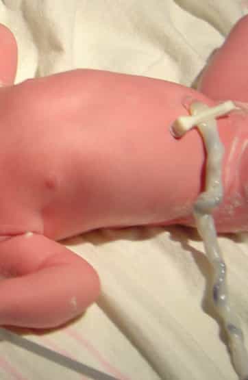 À la naissance, le cordon ombilical est clampé puisque le sang circule toujours entre la mère et l'enfant. Ensuite seulement, il est coupé. © DR