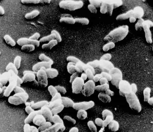 La fièvre Q est provoquée par la bactérie Coxiella burnetii. © DR