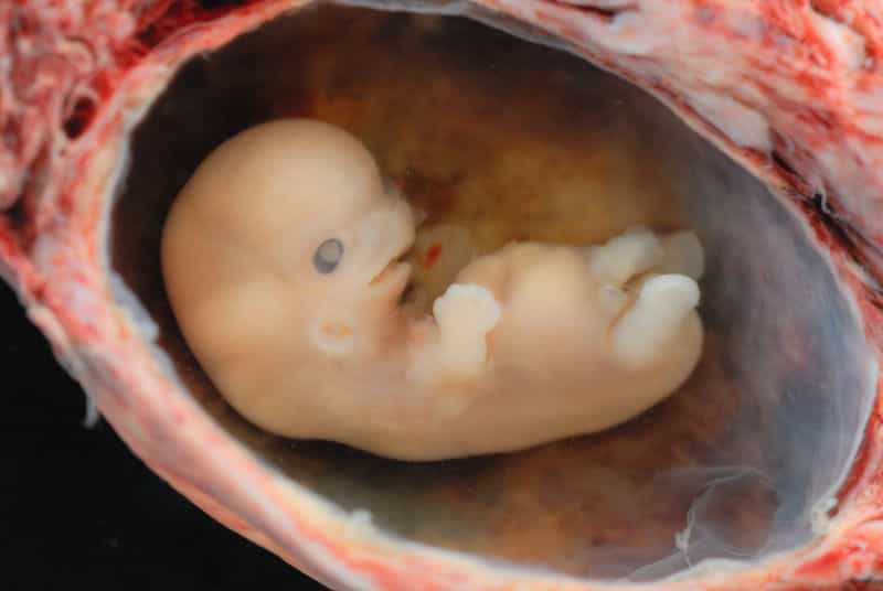 L'allantoïde apparaît chez l'Homme trois semaines après la fécondation. Cet embryon de six semaines en possède déjà une. © lunar caustic, Wikipédia, cc by 2.0