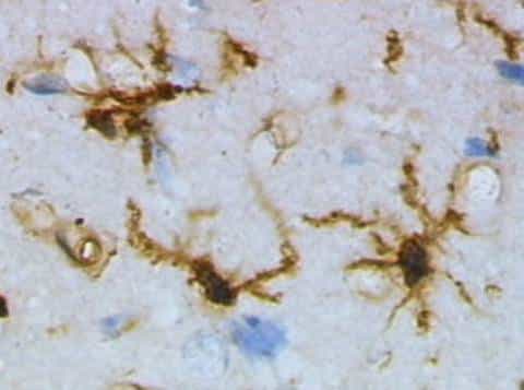 Les cellules microgliales sont colorées en marron. © Grzegor Wicher / Wikimedia Commons (domaine public)