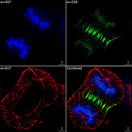 Une mitose est observée au microscope à épifluorescence grâce à différents fluorochromes (l'ADN en bleu, la tubuline en rouge et une protéine centromérique en vert). © F. Lamiot, CC by-sa 3.0