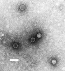 Le poliovirus (vu au microscope électronique) possède une réplicase qui a été largement étudiée en biologie moléculaire. © DR