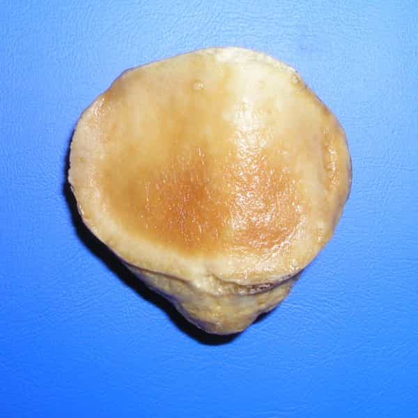 La rotule est un os triangulaire situé dans le genou. © Palica, Wikimedia, domaine public