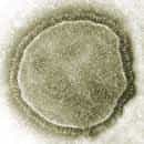 Le virus de la rougeole est sphérique et enveloppé dans une membrane. © AJC1, Flickr, CC by-nc-sa 2.0