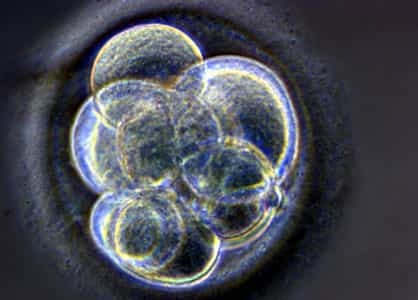 Le tératome peut se former à partir de cellules apportées par des cellules souches. © sante-decouverte