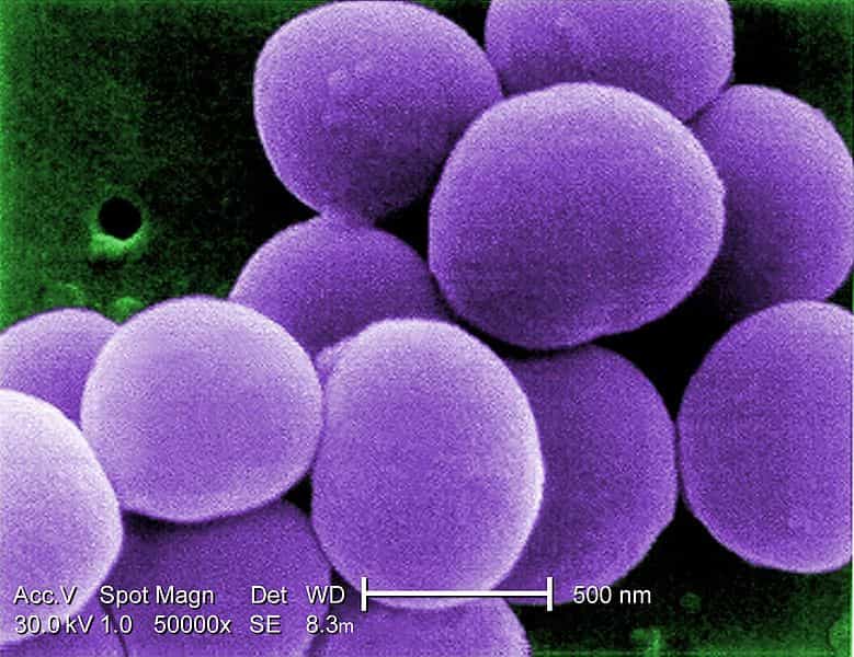 Le staphylocoque doré est une bactérie pathogène pour l'Homme. © DR