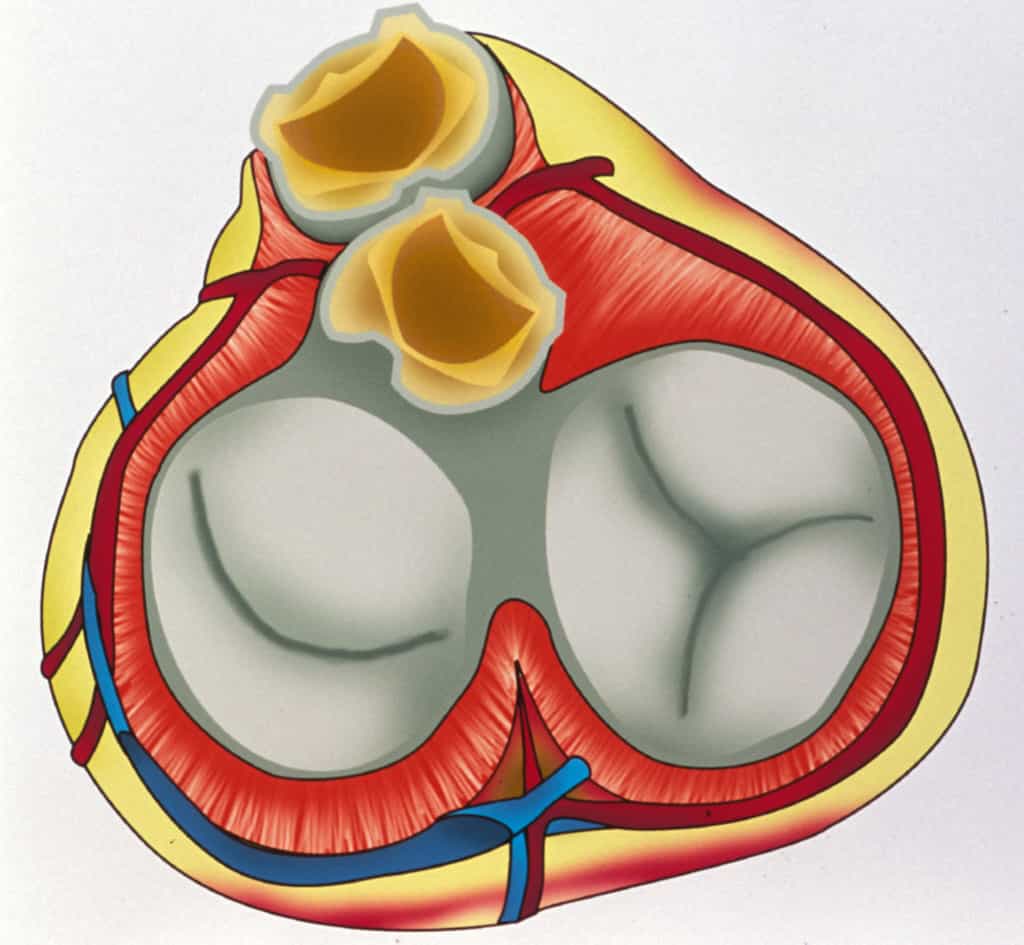 La valvule mitrale permet la régulation du flux sanguin entre oreillette et ventricule gauches. © Phovoir