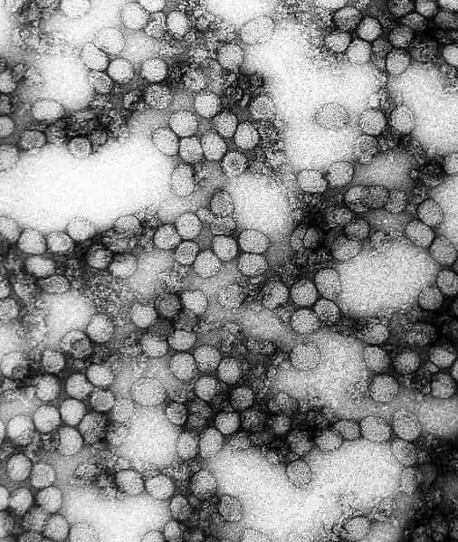 Le virus Amaril, observé ici au microscope électronique à transmission, cause la fièvre jaune. © DR