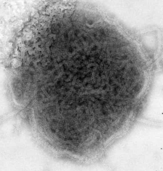 Le virus des oreillons fait partie de la famille des Paramyxoviridae. © DR