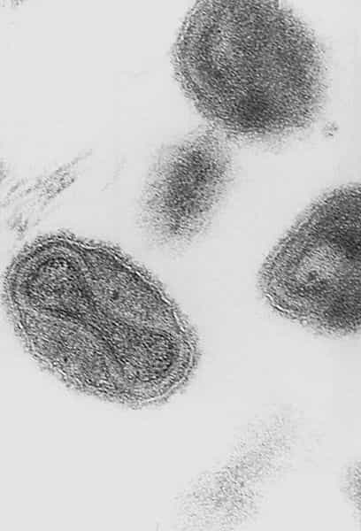 Le virus de la variole forme une particule virale complexe. © DR