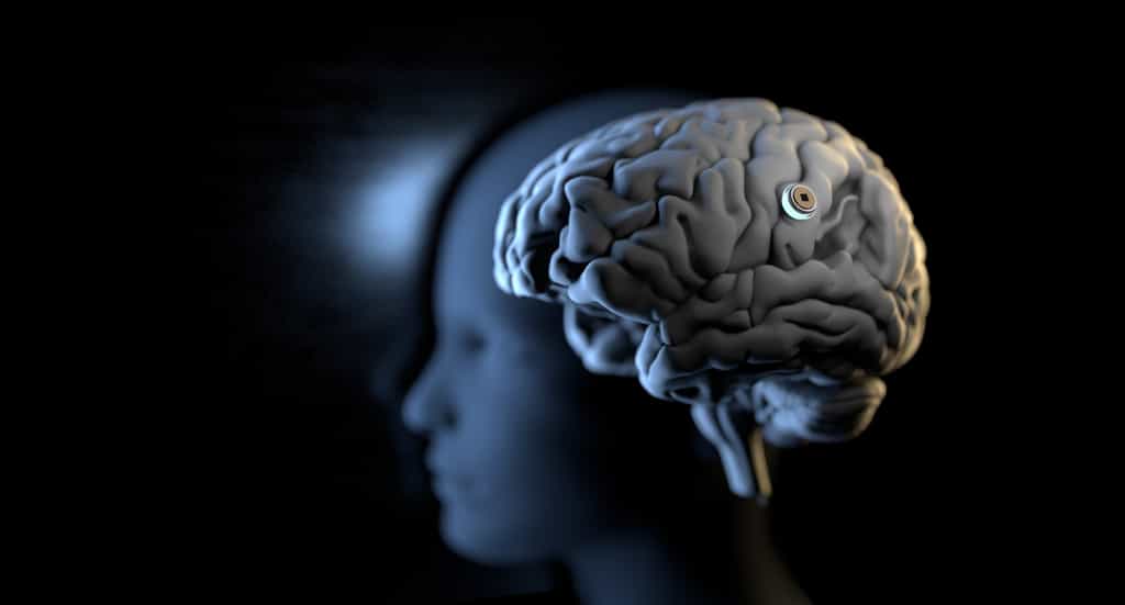 Les implants cérébraux sont porteurs de promesses, mais sont-ils sans danger ? © RareStock, Adobe Stock