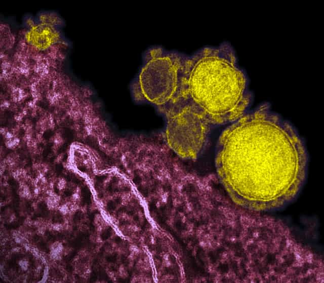 En fausses couleurs, des virus MERS-CoV (Middle East Respiratory Syndrome Coronavirus) observés au microscope électronique à transmission. Ce parasite appartient à la famille des coronavirus, caractérisés par une coque protégeant le matériel génétique, constitué d'ARN. © NIAID/AJ Cann, CC by sa 2.0