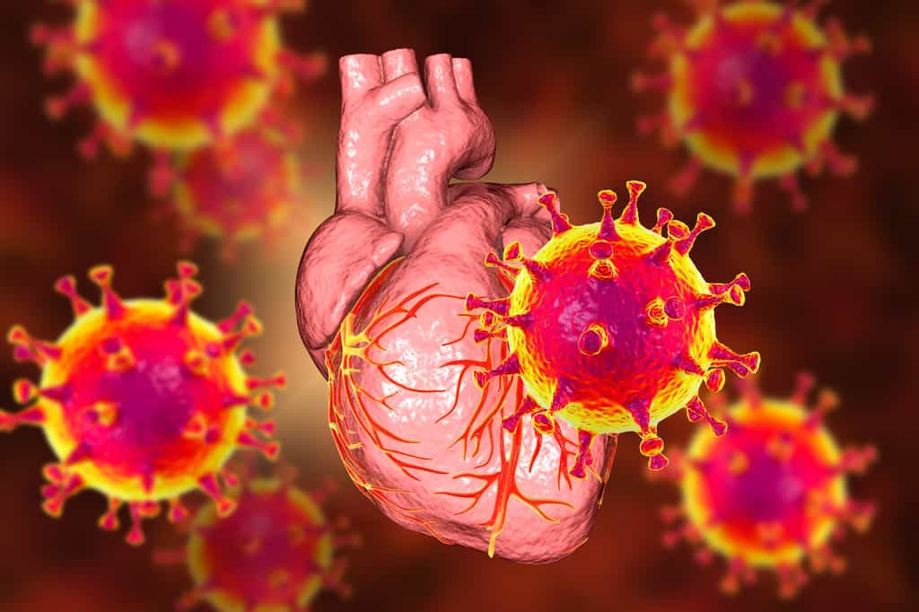 La myocardite est une inflammation du muscle cardiaque habituellement provoquée par un virus. Le coronavirus est-il plus dangereux que le vaccin. © Kateryna_Kon, Adobe Stock