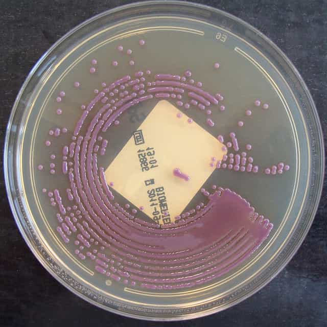 Les bactéries qui portent le gène NDM-1 sont résistantes à de nombreux antibiotiques, ce qui rend le traitement plus difficile. © Nathan Reading, Flickr, CC by-nc-nd 2.0