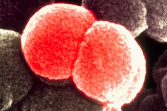 Le méningocoque Neisseria meningitidis se présente sous la forme d'un diplocoque : les bactéries sphériques identiques sont regroupées par paires. © Sanofi Pasteur, Flickr, CC by-nc-nd 2.0