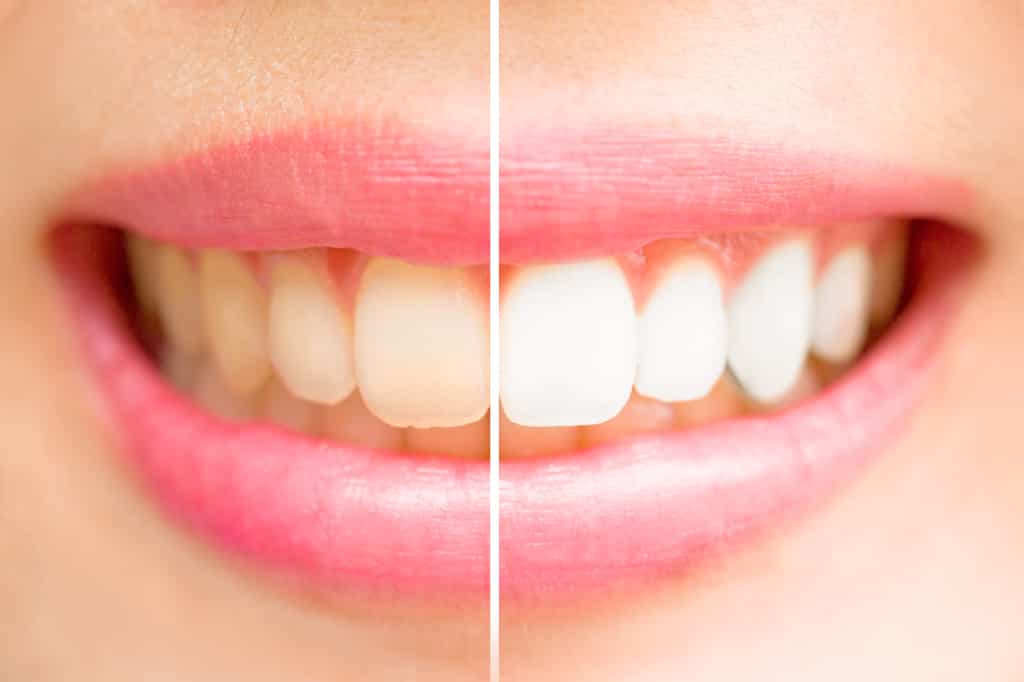 Des dents plus blanches sans traitement, c’est possible. © jayzynism, Fotolia