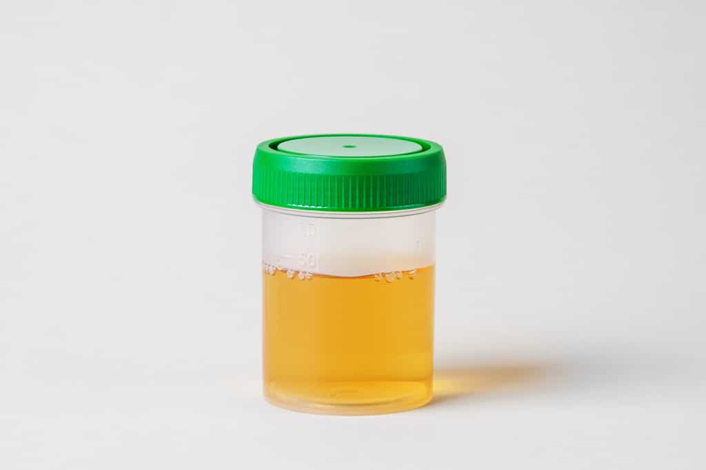 La couleur jaune de l’urine est liée à la présence d’urobiline. © adragan, Adobe Stock