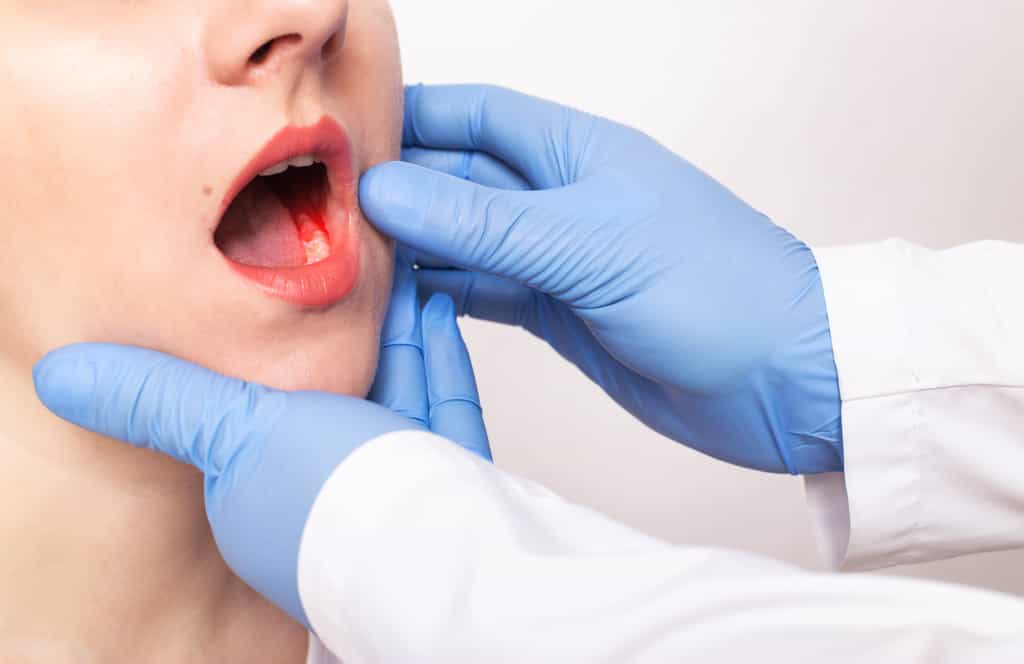 Une bonne hygiène dentaire est essentielle pour limiter l'apparition de nombreuses pathologies. © Henadzy, Adobe Stock