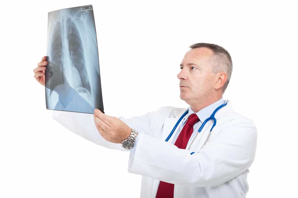 Le diagnostic d’embolie pulmonaire peut se faire à l’aide d’une radiographie du thorax. © Minerva Studio, Shutterstock
