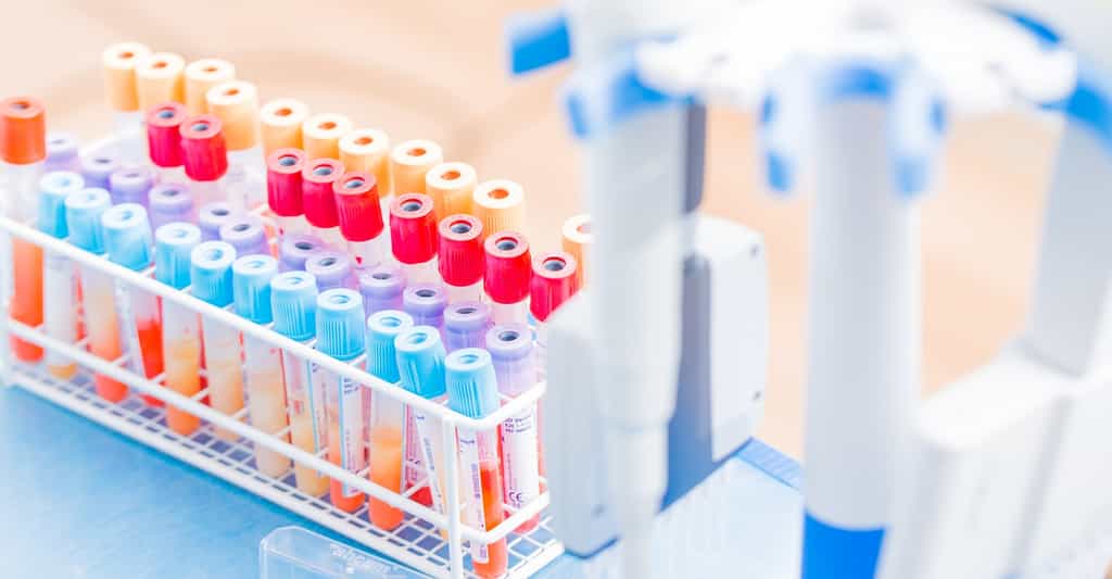 La cytométrie en flux permet de trier des cellules en fonction de leurs propriétés physiques et optiques dans des échantillons hétérogènes, comme le sang. © science photo, Shutterstock