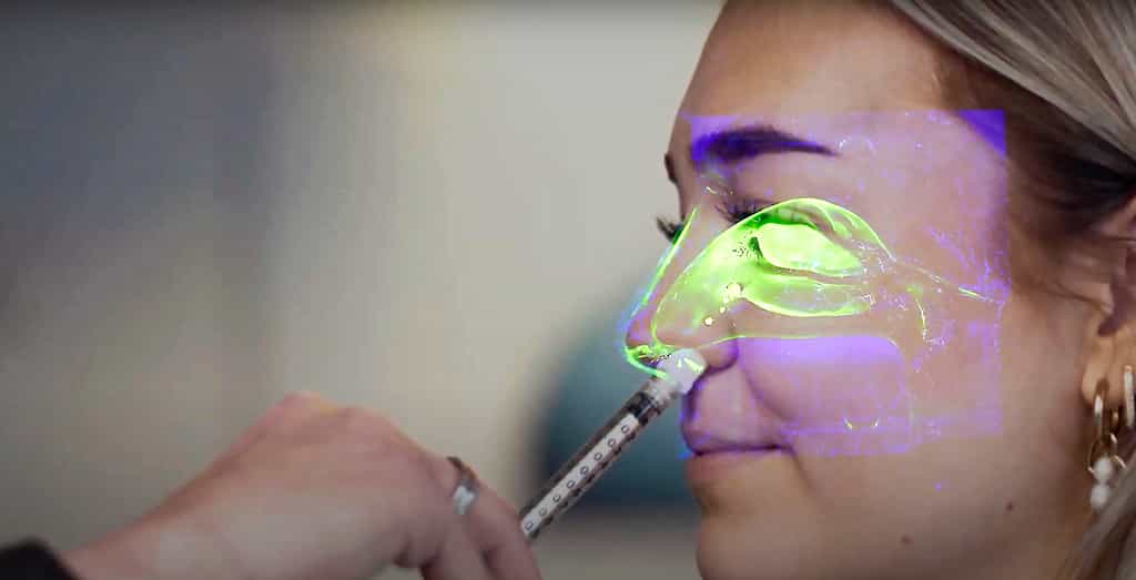 Avec le concours de la société Medspray, l'atomiseur de pulvérisation intranasale pourrait permettre une diffusion optimale et un meilleur effet thérapeutique dans la cavité et la muqueuse nasale. © Capture d'écran de la vidéo YouTube Medspray