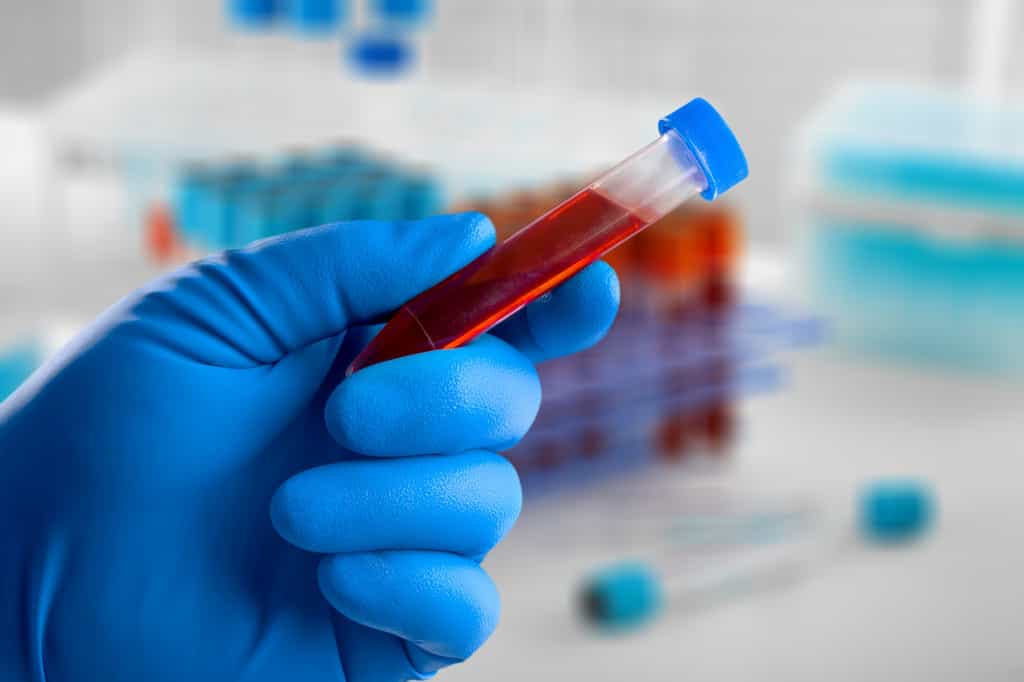 Les tests sanguins montrent leur preuve dans la détection précoce du cancer. © BillionPhotos.com, Adobe Stock