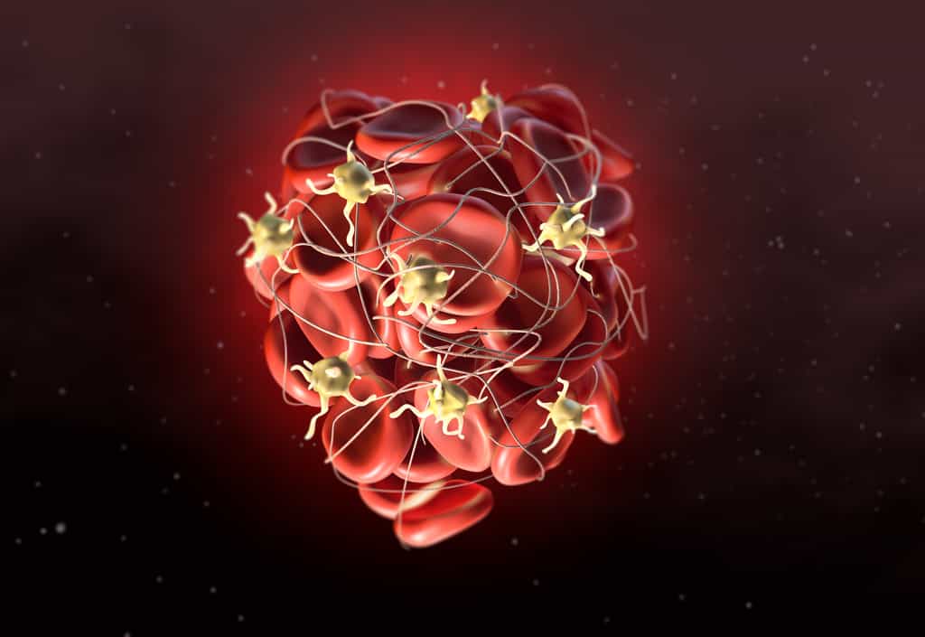 Formation d'un thrombus : les plaquettes favorisent la formation de fibrine emprisonnant les globules rouges. © Axel Kock, Adobe Stock