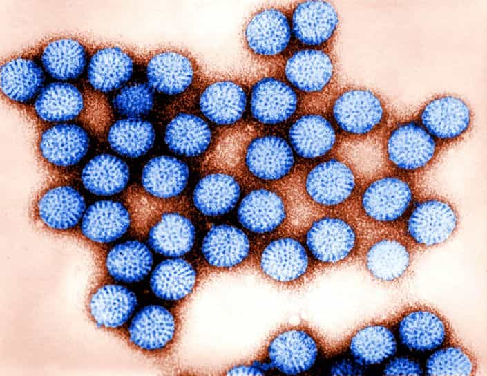Les norovirus sont responsables de nombreuses épidémies de gastro-entérite. © public-domain-image.com, DP