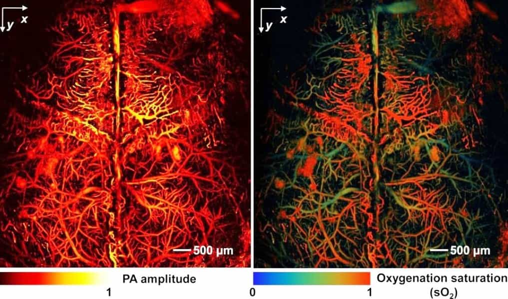 Ce cerveau de souris a été imagé in vivo, sans agent de contraste, par microscopie photoacoustique (PAM). Les chercheurs ont utilisé l'hémoglobine dans les globules rouges du sang pour fournir le contraste (image de gauche). Les niveaux de saturation en oxygène dans l'hémoglobine dans le même cerveau de souris révèlent les artères et les veines corticales (image de droite). © Junjie Yao et Lihong Wang, WUSTL 