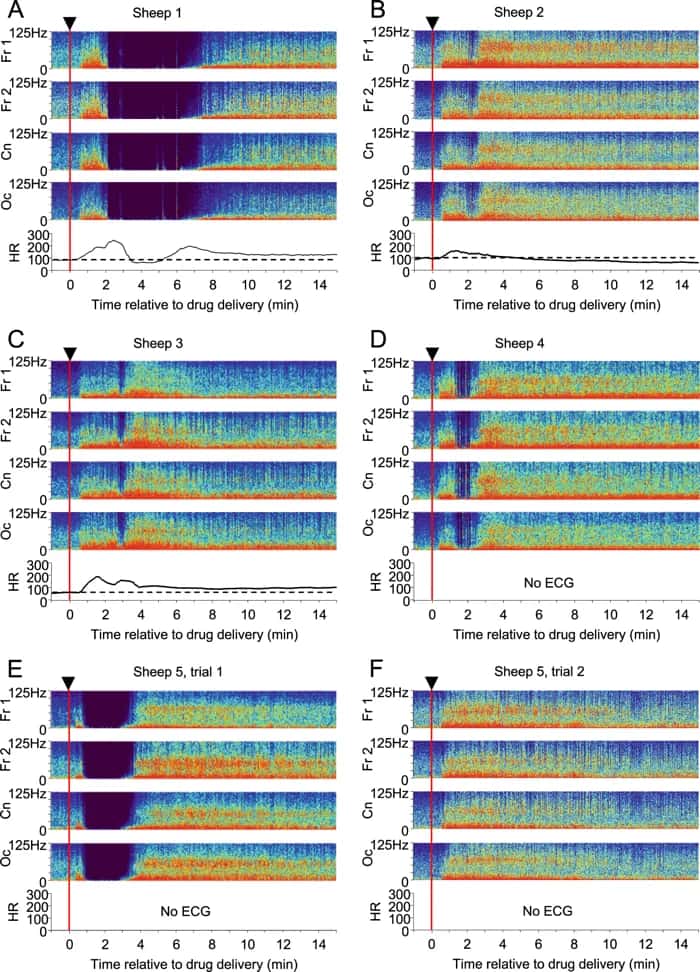 Les relevés EEG des six moutons étudiés par les chercheurs © Nicol & Morton, <em>Scientific Reports</em>, 2020