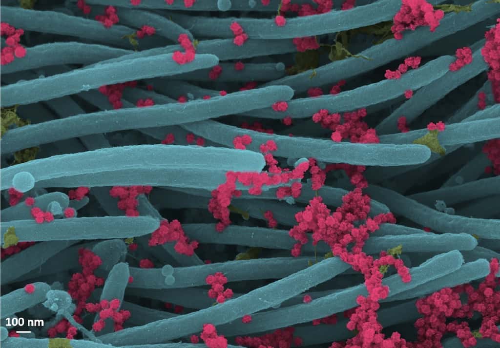 Les virions du SARS-CoV-2 (en rouge) tapissent les cellules ciliées bronchiques (en bleu). © Ehre Lab, <em>UNC School of Medicine</em>