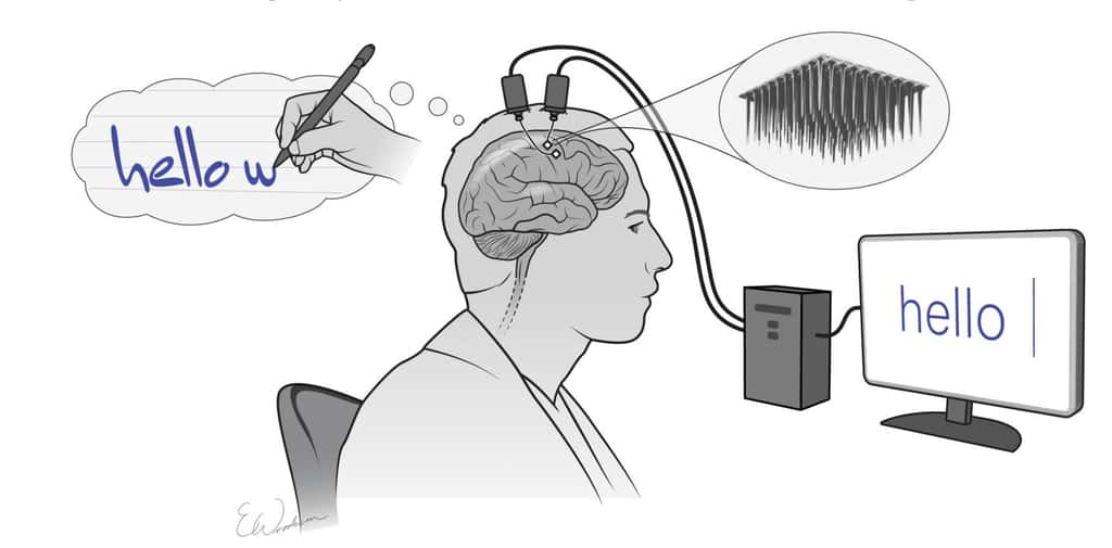 Deux réseaux d'électrodes implantés enregistrent l'activité cérébrale produite en pensant à l'écriture de lettres. Ces informations sont ensuite collectées et traitées en temps réel par un ordinateur, qui convertit ces données en mots sur un écran. © <em>Courtesy of Shenoy lab & Erika Woodrum</em> 