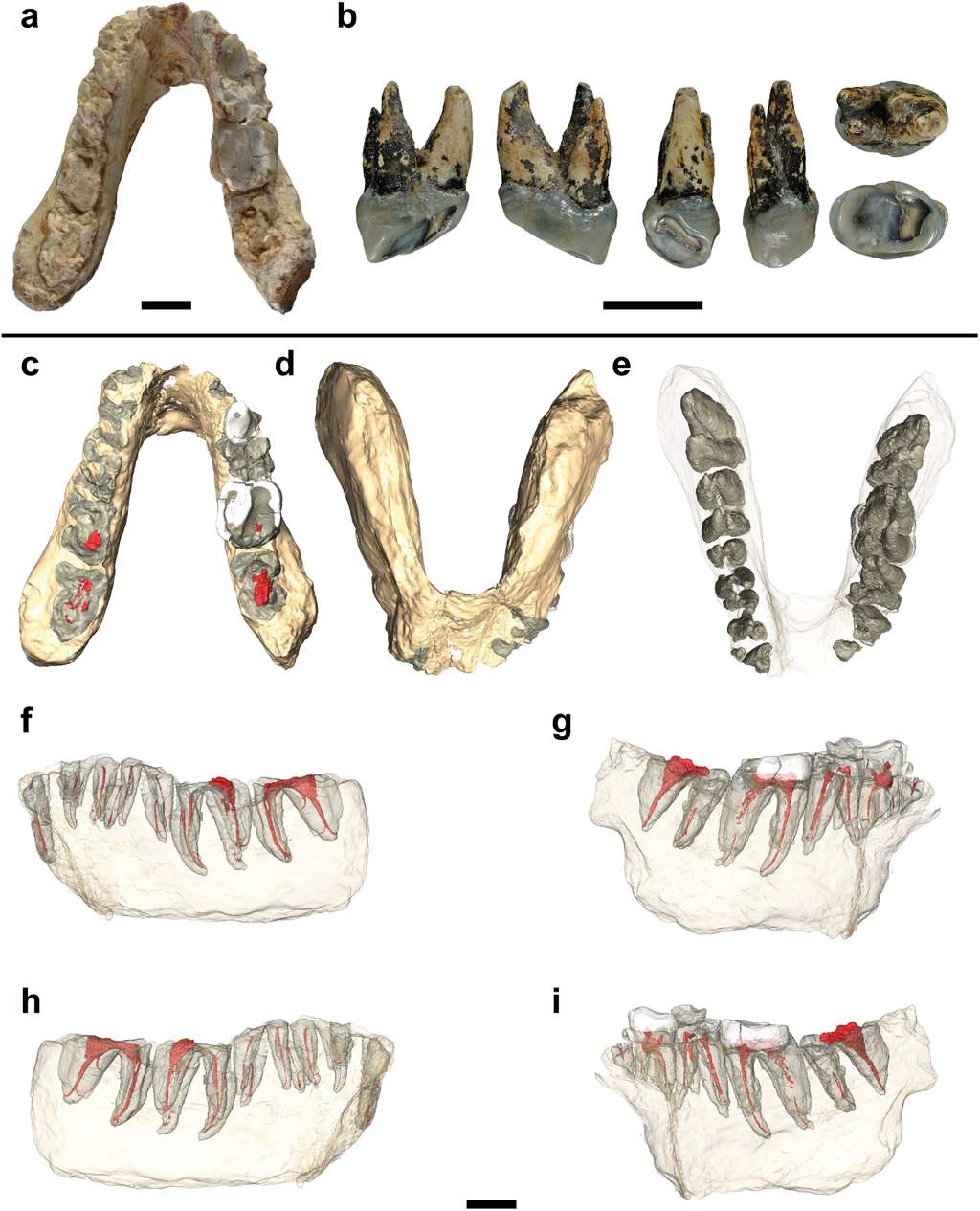 En haut, la mandibule de <em>Graecopithecus freybergi</em> trouvée à Pyrgos, en Grèce et, à gauche, la dent découverte à Azmaka, en Bulgarie, et appartenant à un animal appartenant au même genre, <em>Graecopithecus sp.</em>, si ce n'est à la même espèce. De c à e, différentes vues de la mandibule et, de f à i, les images construites au scanner CT, montrant l'implantation des dents. Les barres d'échelle représentent toutes 1 cm. © Jochen Fuss <em>et al.</em>, <em>Plos One</em>