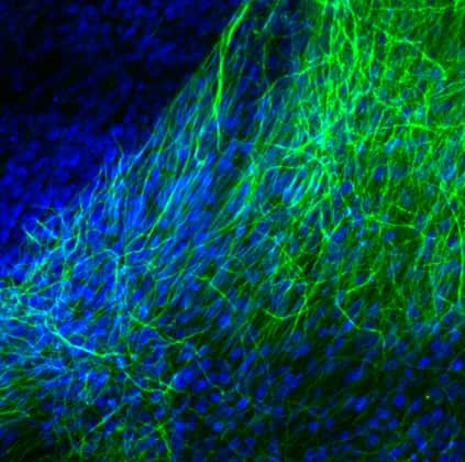 Des neurones d'un mini-cerveau rendus visibles en microscopie par un marquage fluorescent. Ils se développent en trois dimensions. © CellTechs
